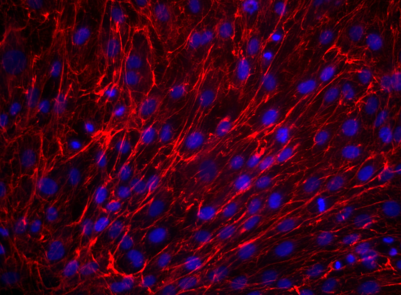 Fibronectin_A647_TDS_D12_Merged.png